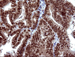 UPRT Antibody in Immunohistochemistry (Paraffin) (IHC (P))