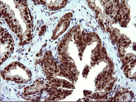 UPRT Antibody in Immunohistochemistry (Paraffin) (IHC (P))