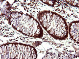 UPRT Antibody in Immunohistochemistry (Paraffin) (IHC (P))