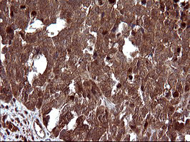 UPRT Antibody in Immunohistochemistry (Paraffin) (IHC (P))