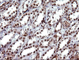 UPRT Antibody in Immunohistochemistry (Paraffin) (IHC (P))