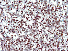 UPRT Antibody in Immunohistochemistry (Paraffin) (IHC (P))