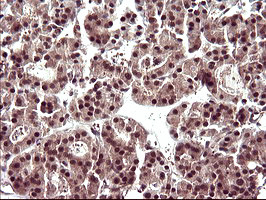 UPRT Antibody in Immunohistochemistry (Paraffin) (IHC (P))