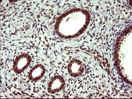 UPRT Antibody in Immunohistochemistry (Paraffin) (IHC (P))