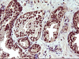 UPRT Antibody in Immunohistochemistry (Paraffin) (IHC (P))