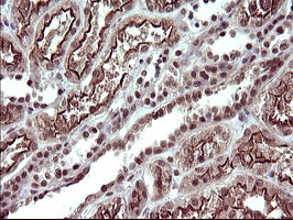 UPRT Antibody in Immunohistochemistry (Paraffin) (IHC (P))