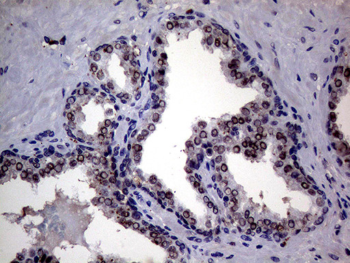 UPRT Antibody in Immunohistochemistry (Paraffin) (IHC (P))