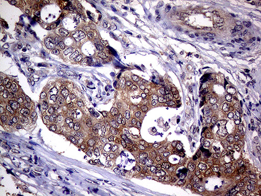 UPRT Antibody in Immunohistochemistry (Paraffin) (IHC (P))