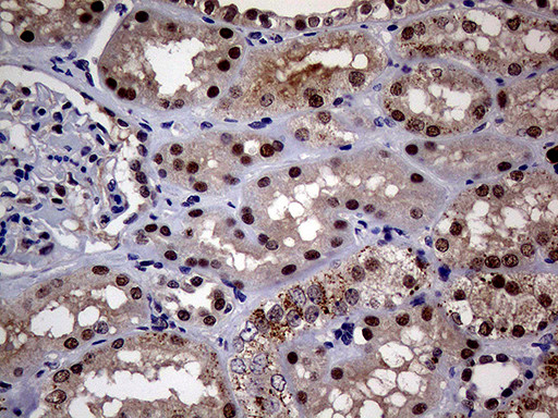 UPRT Antibody in Immunohistochemistry (Paraffin) (IHC (P))