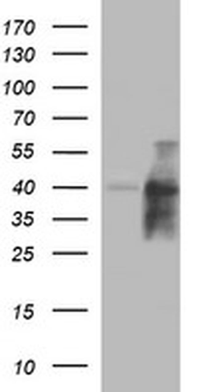 UPRT Antibody in Western Blot (WB)