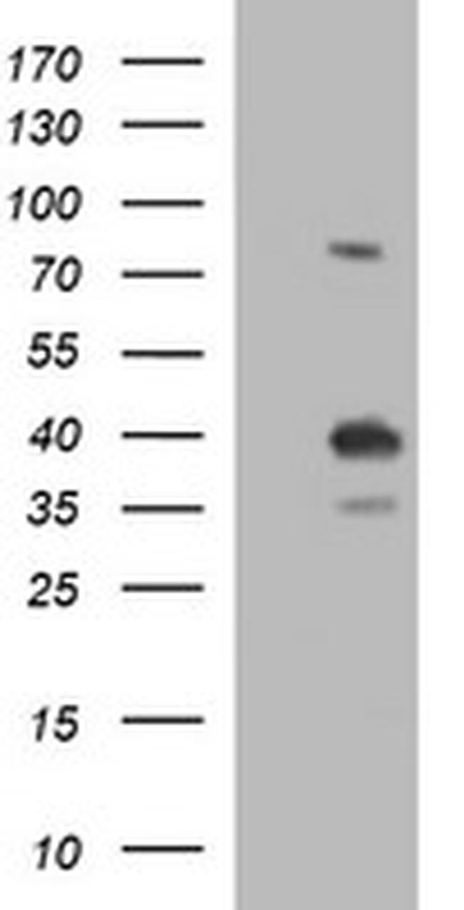 UPRT Antibody in Western Blot (WB)