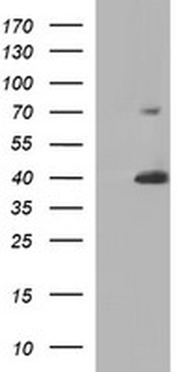 UPRT Antibody in Western Blot (WB)