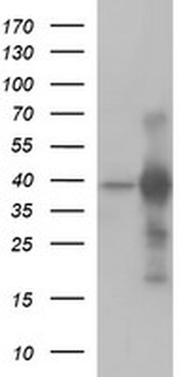 UPRT Antibody in Western Blot (WB)