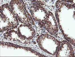 UQCRC1 Antibody in Immunohistochemistry (Paraffin) (IHC (P))