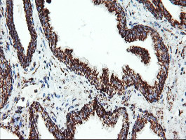 UQCRC1 Antibody in Immunohistochemistry (Paraffin) (IHC (P))