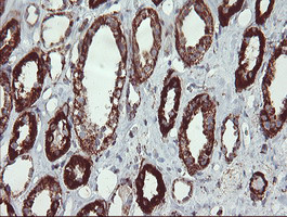 UQCRC1 Antibody in Immunohistochemistry (Paraffin) (IHC (P))