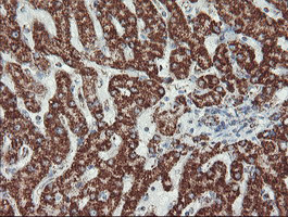 UQCRC1 Antibody in Immunohistochemistry (Paraffin) (IHC (P))