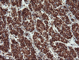 UQCRC1 Antibody in Immunohistochemistry (Paraffin) (IHC (P))