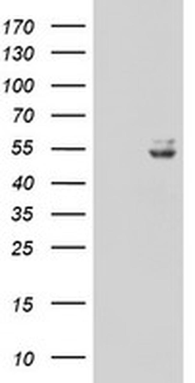 UQCRC1 Antibody in Western Blot (WB)