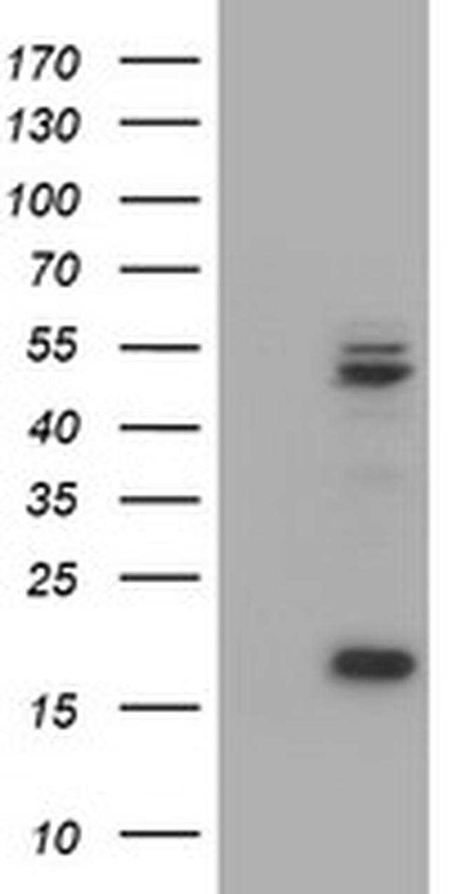 UQCRC1 Antibody in Western Blot (WB)