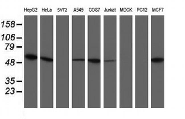 UQCRC1 Antibody in Western Blot (WB)