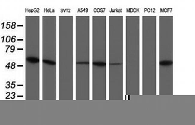 UQCRC1 Antibody in Western Blot (WB)