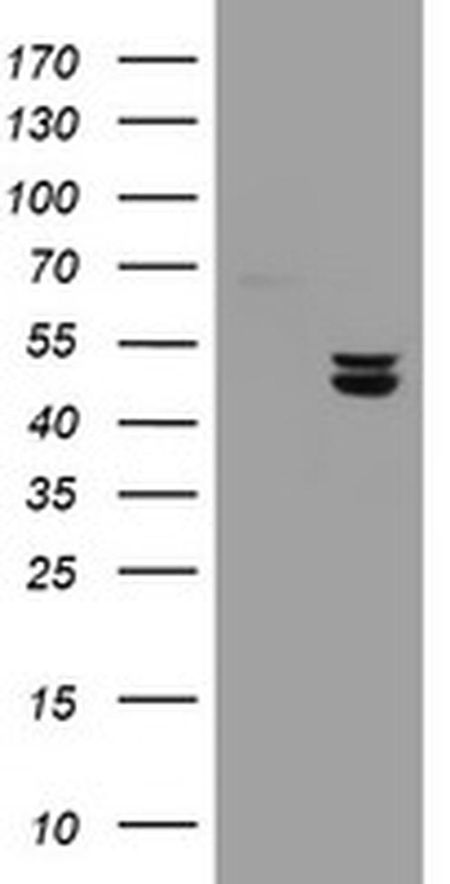 UQCRC1 Antibody in Western Blot (WB)