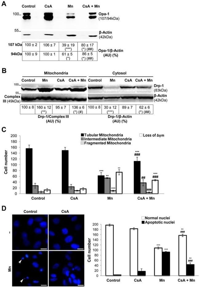 UQCRC1 Antibody in Western Blot (WB)