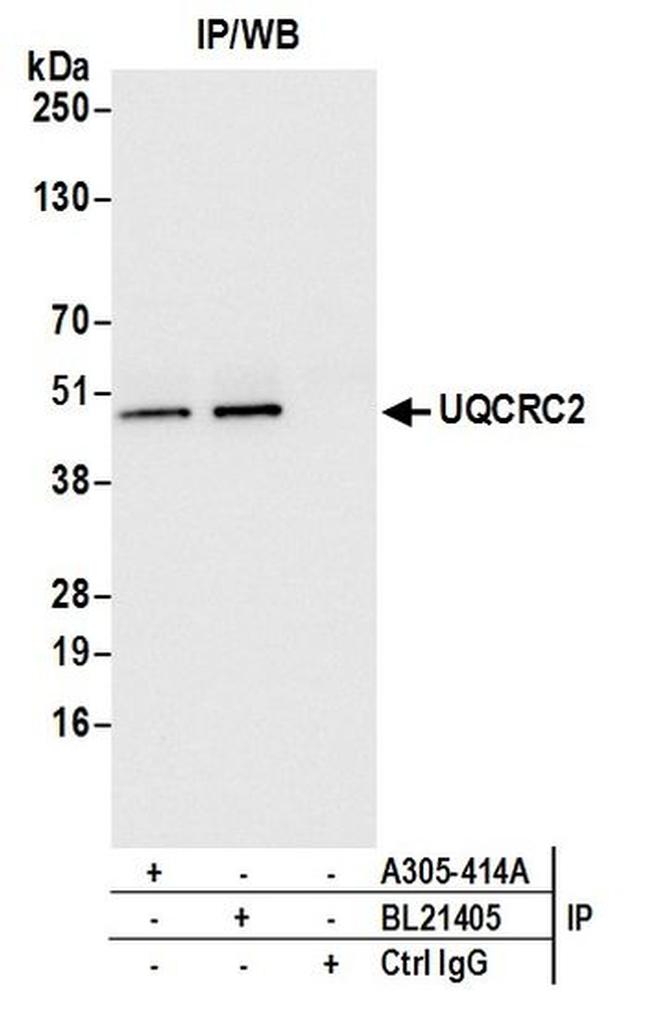 UQCRC2 Antibody in Western Blot (WB)