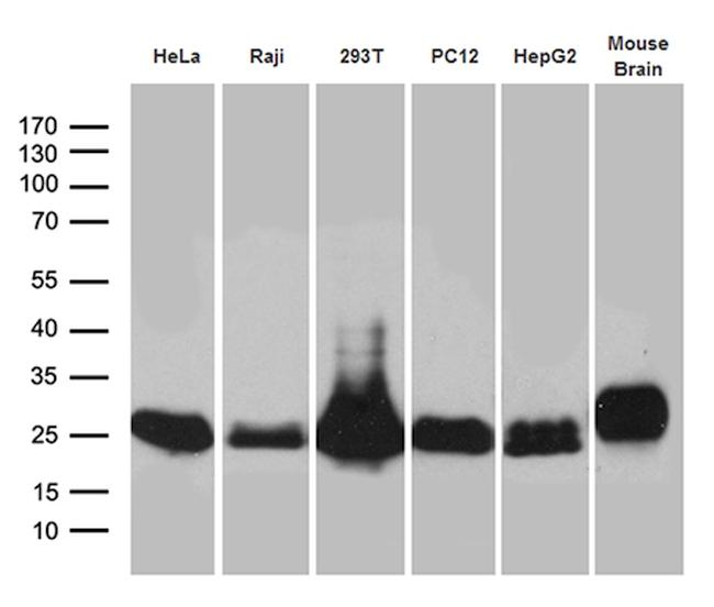 UQCRFS1 Antibody in Western Blot (WB)