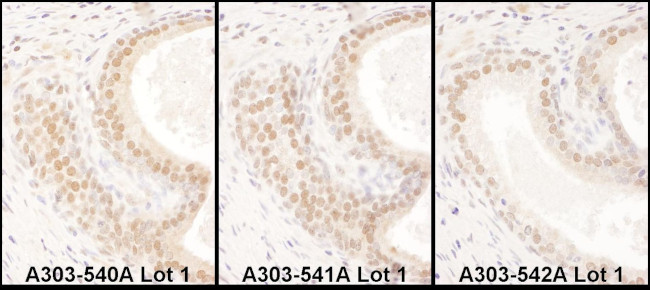 USF2 Antibody in Immunohistochemistry (IHC)