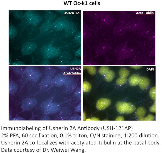 Usherin Antibody in Immunohistochemistry (IHC)