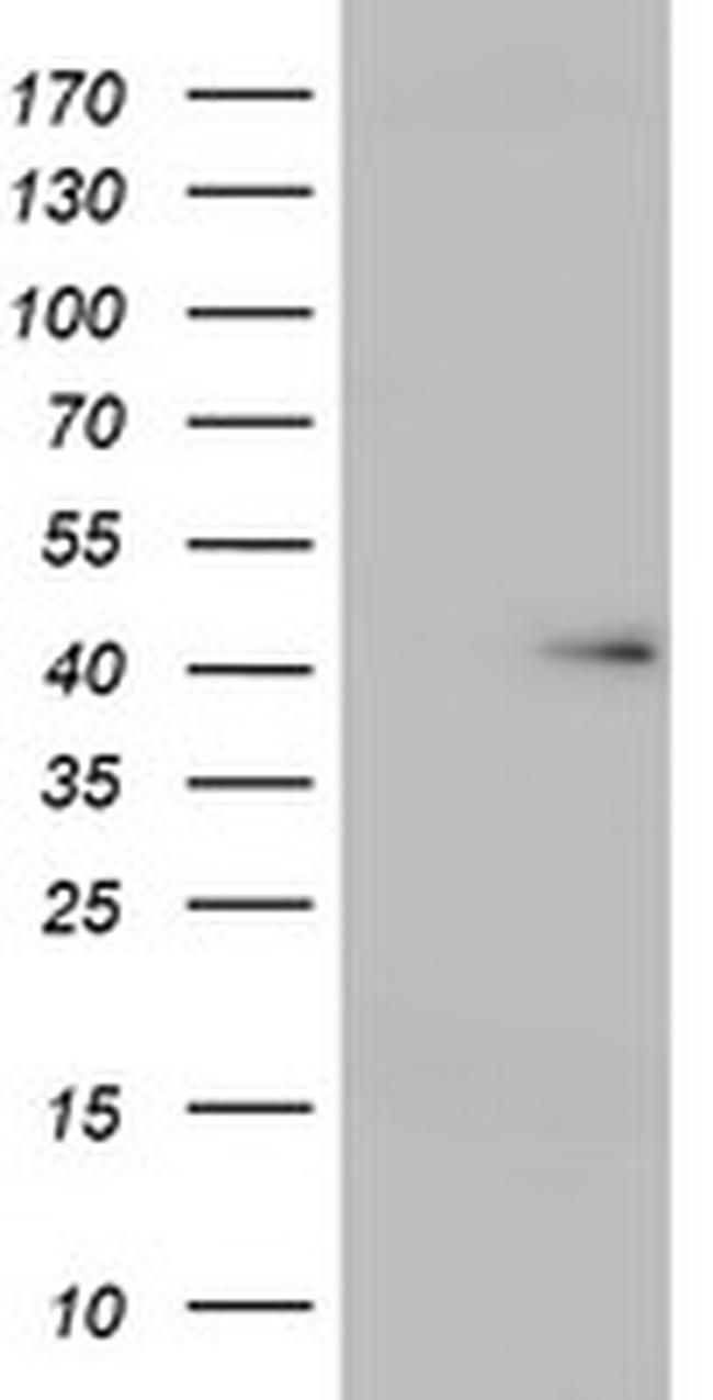 USP12 Antibody in Western Blot (WB)