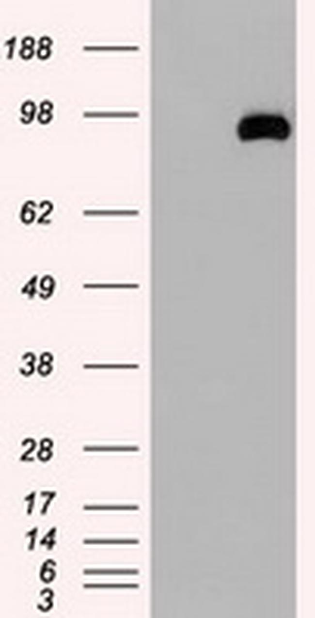 USP13 Antibody in Western Blot (WB)