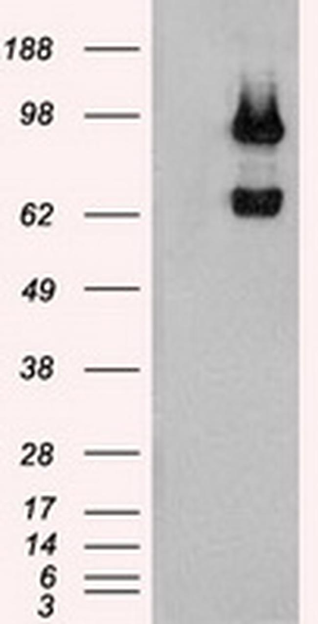USP13 Antibody in Western Blot (WB)