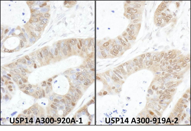 USP14 Antibody in Immunohistochemistry (IHC)