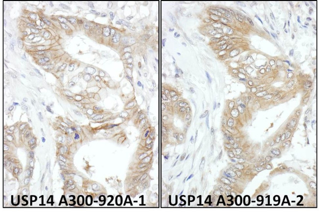 USP14 Antibody in Immunohistochemistry (IHC)