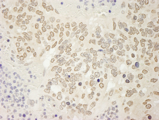 USP15 Antibody in Immunohistochemistry (IHC)