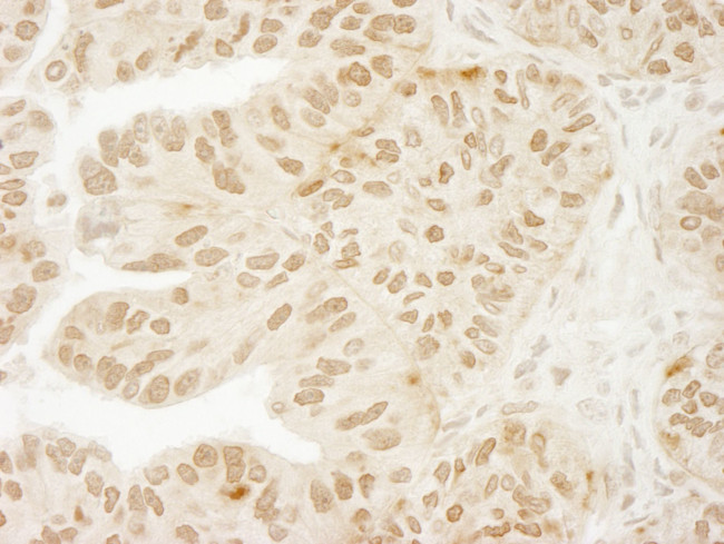 USP15 Antibody in Immunohistochemistry (IHC)