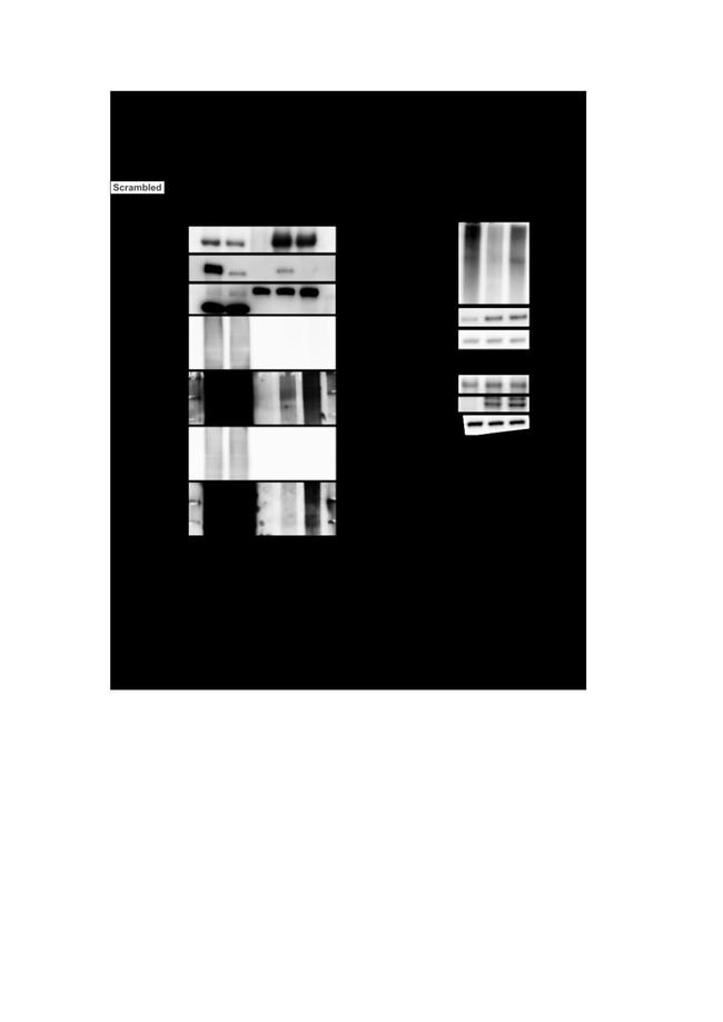 USP17L2 Antibody in Western Blot (WB)