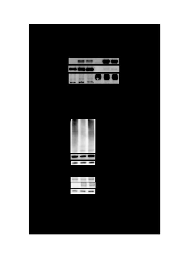 USP17L2 Antibody in Western Blot (WB)