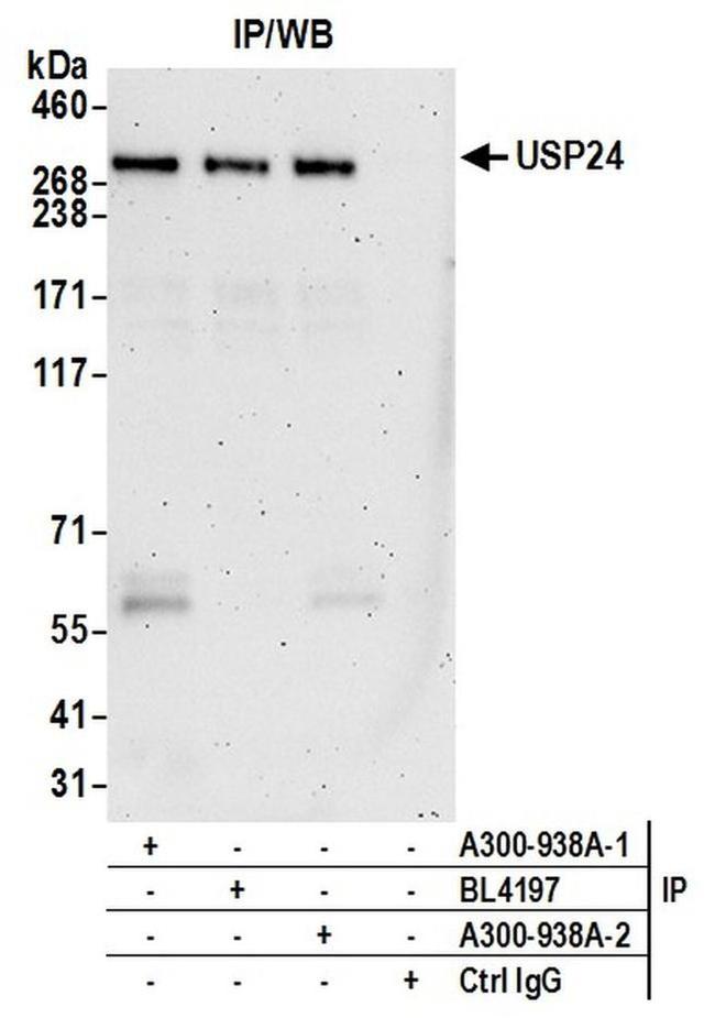 USP24 Antibody in Western Blot (WB)