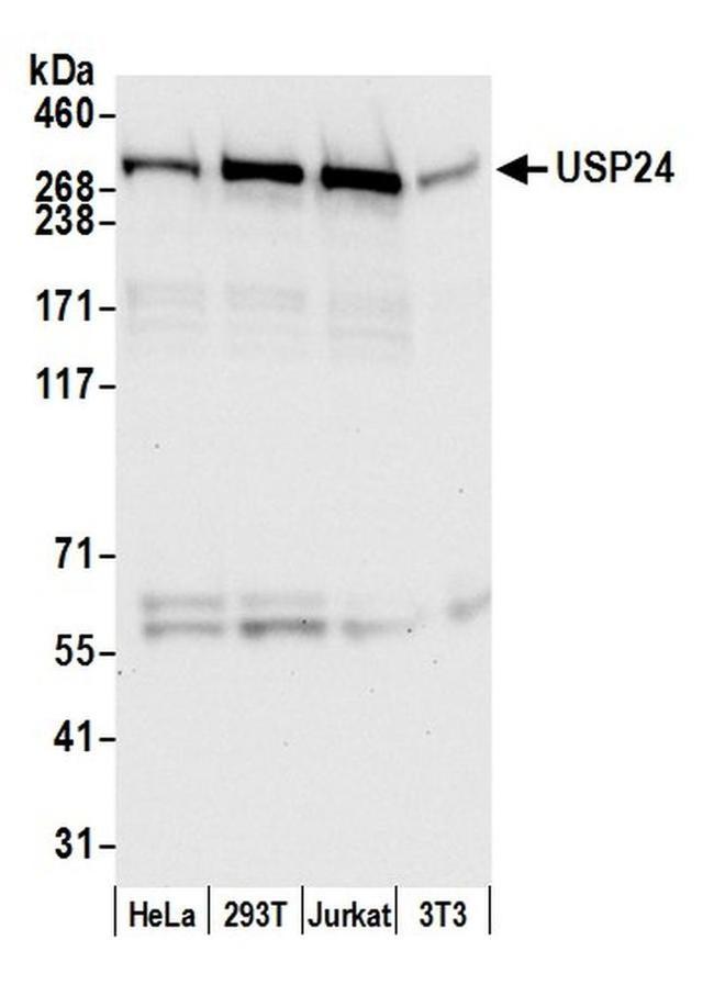 USP24 Antibody in Western Blot (WB)