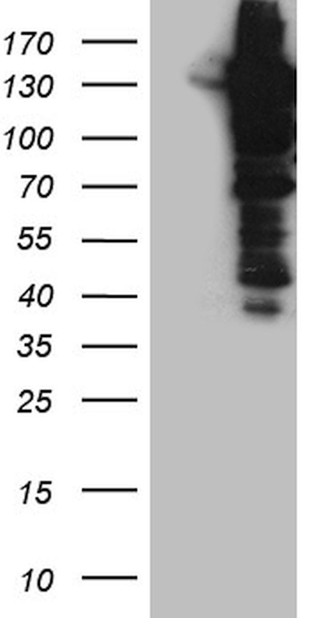 USP25 Antibody in Western Blot (WB)