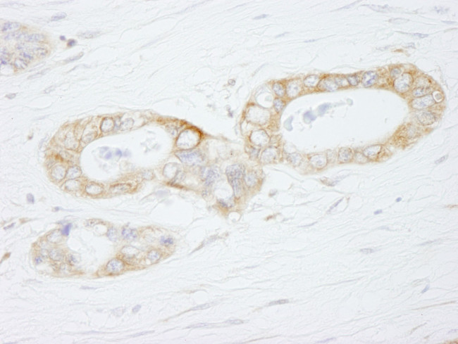 USP3 Antibody in Immunohistochemistry (IHC)