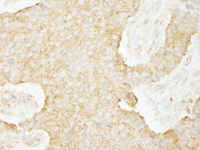 USP3 Antibody in Immunohistochemistry (IHC)