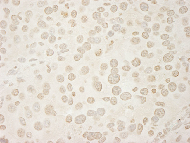 USP33 Antibody in Immunohistochemistry (IHC)