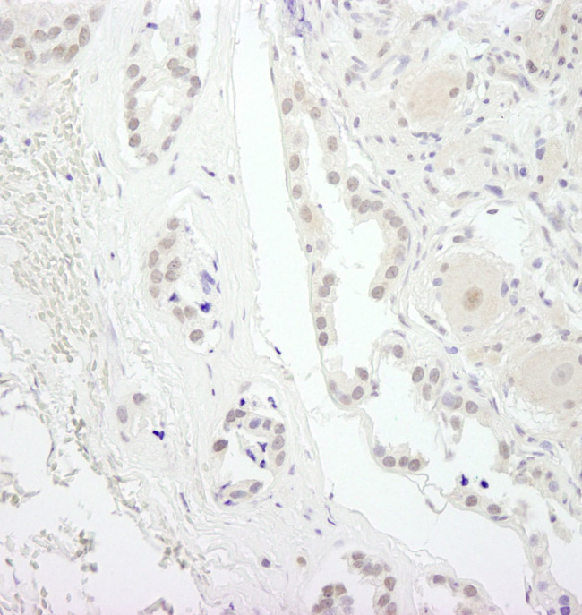 USP34 Antibody in Immunohistochemistry (IHC)