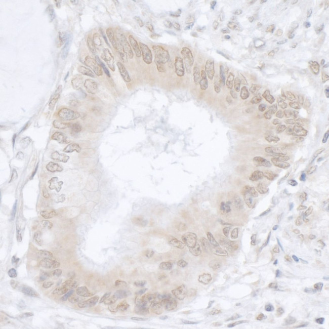 USP36/DUB1 Antibody in Immunohistochemistry (IHC)