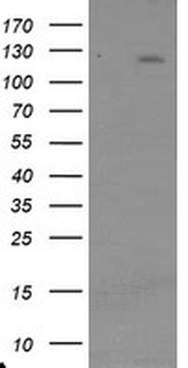 USP36 Antibody in Western Blot (WB)